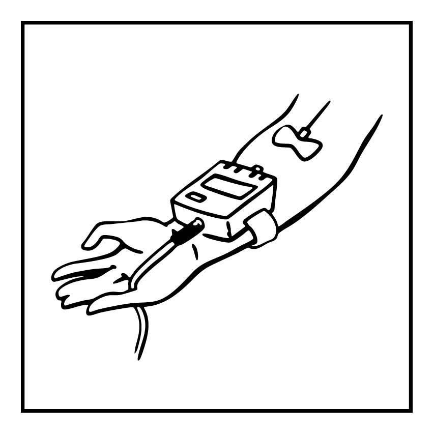 Ein Unterarm mit Infusionsnadelzugang und medizinischem Kästchen